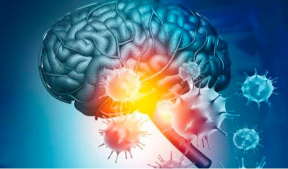 澳专家警告：新冠病毒恐杀死脑细胞，引发“帕金森、阿尔兹海默症”类似疾病 